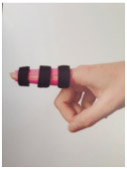 Finger-Extension-Orthosis