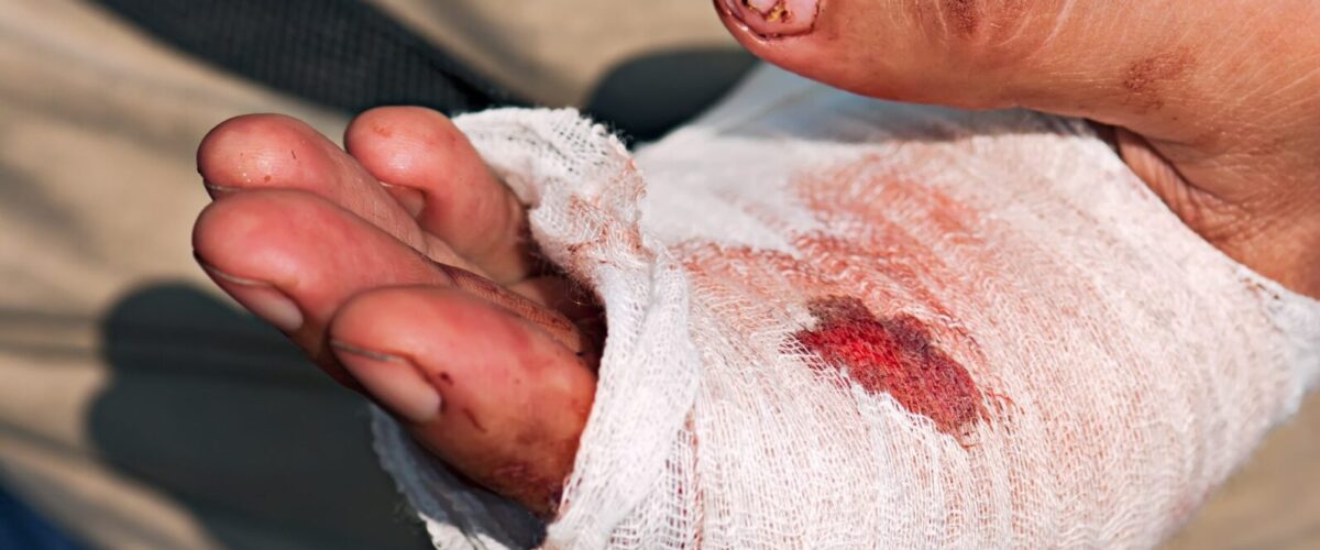 hand injury requiring urgent attention from work related accident